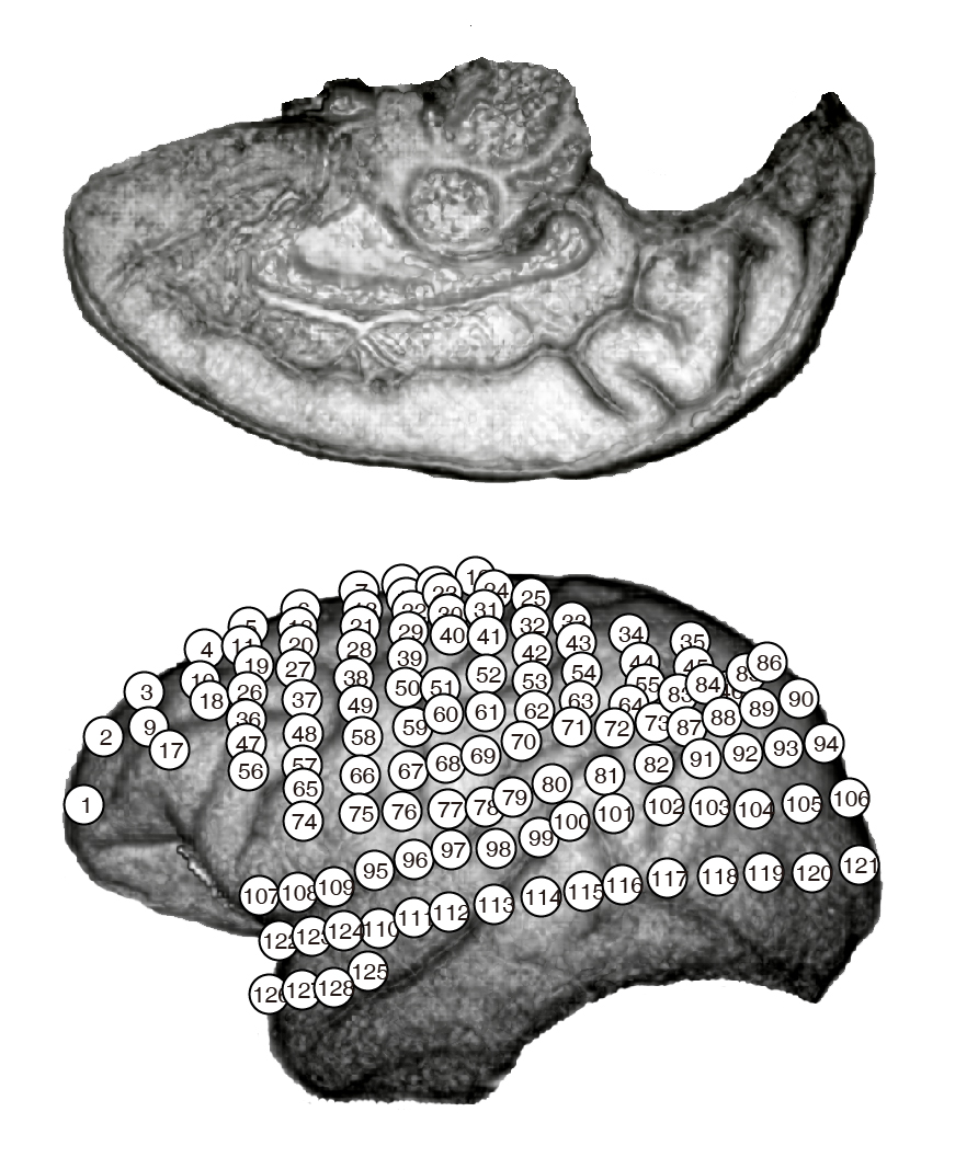 Kin2